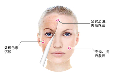 激光美容是一种什么样的仪器设备？拥有什么特点？