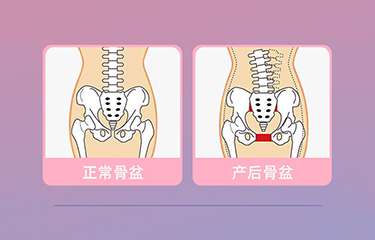 盆底肌修复仪器怎么样？哪些人可以使用它呢