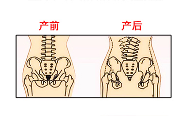 月子期间盆骨仪器修复时间有限制吗？与手法修复相比哪个效果好？